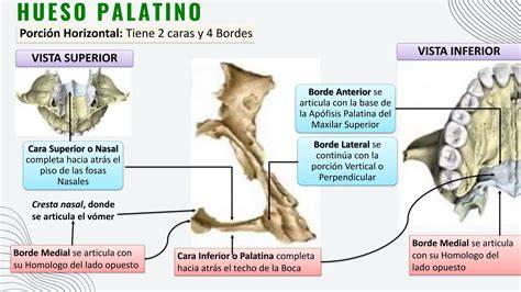 Tirantes vestibular y palatino de composite